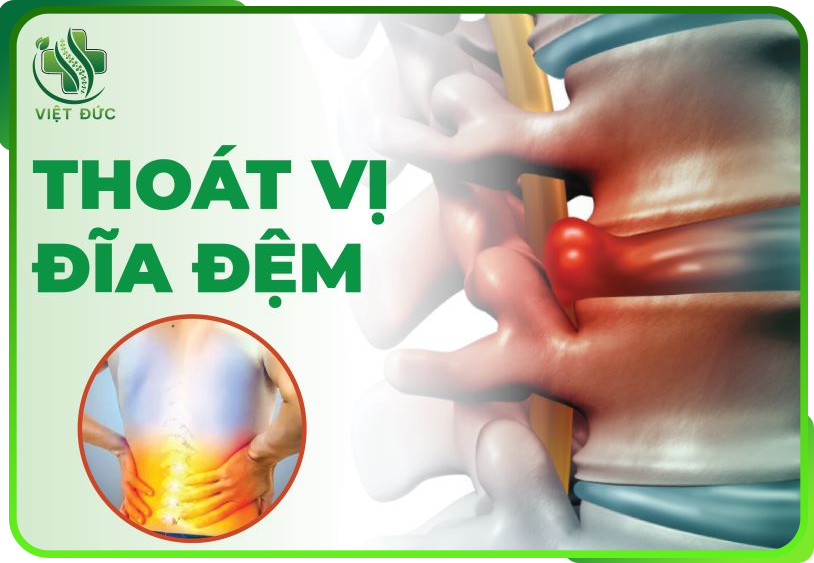 Bệnh thoát vị